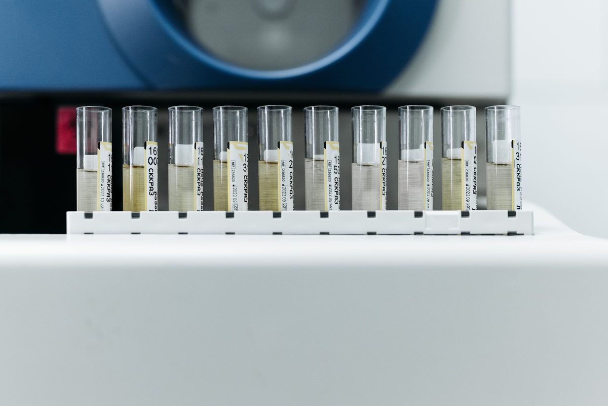 Bloodwork and lab monitoring for TRT in Sudbury